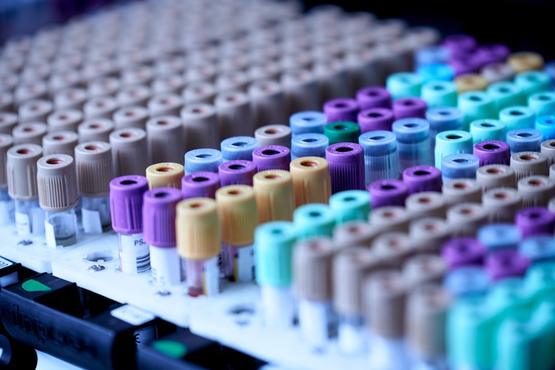 Rows of medical blood collection tubes with colorful caps in a laboratory rack